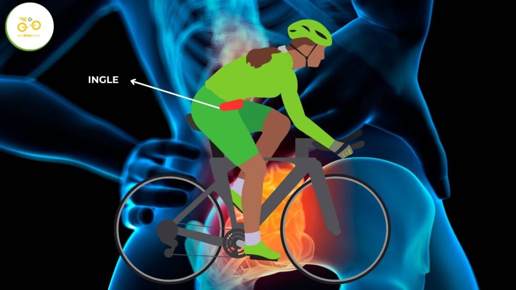 Lesiones ciclismo: dolor en la zona inguinal